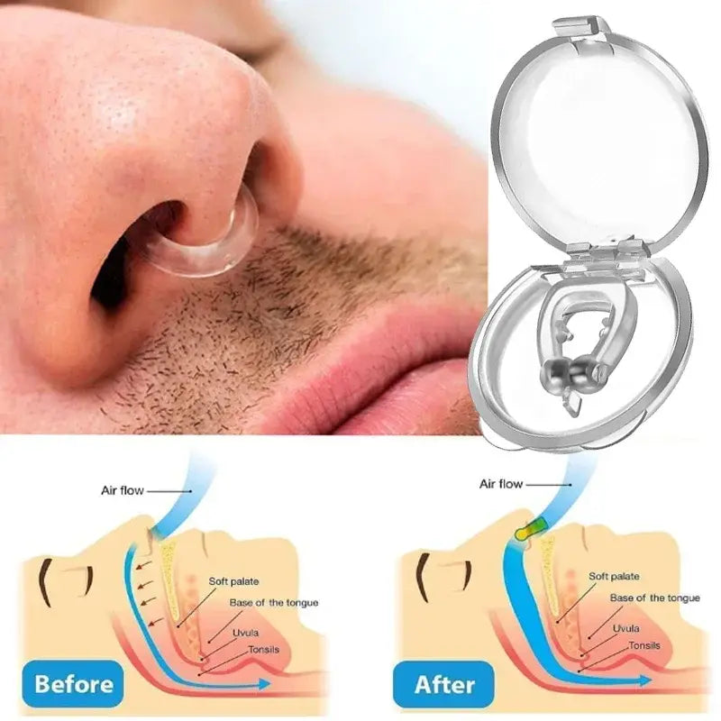 SleepShield- Anti-Snoring Nose Clip