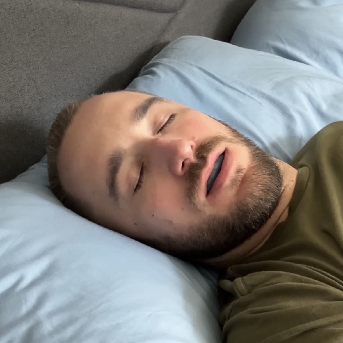 SleepShield™ - Anti-Snoring Mouthpiece